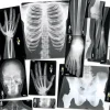 Human X-Rays - Set of 18